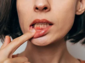 Jak zapobiegać powstawaniu ran w jamie ustnej?